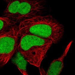 HMGN1/HMG14 Antibody, Novus Biologicals 0.1mL; Unlabeled:Antibodies, Polyclonal
